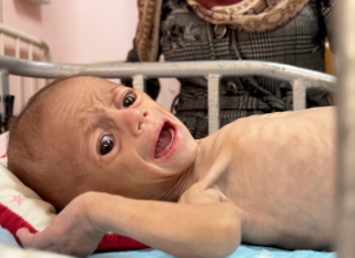 Israel – Palestine Conflict LIVE: Gaza starves under Israeli blockade, US says ceasefire in question